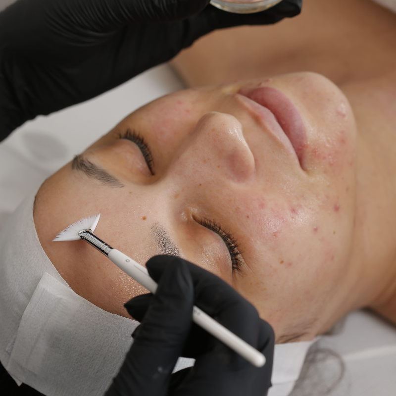 Peeling doux Dermalogica©